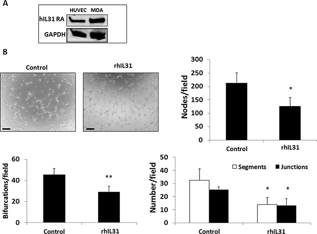 IL31 directly inhibits endothelial cell tube formation.
