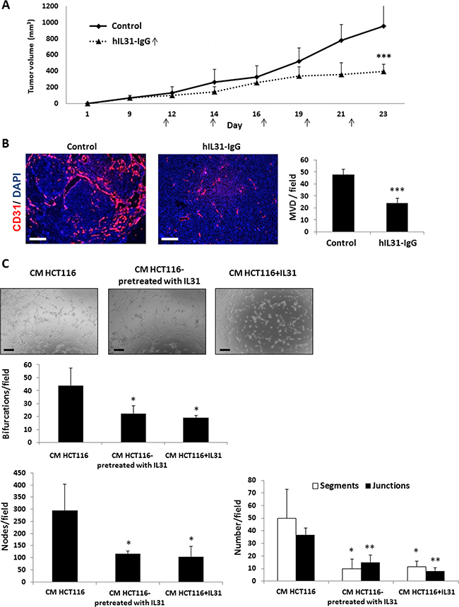 Human IL31-IgG inhibits tumor growth and angiogenesis.