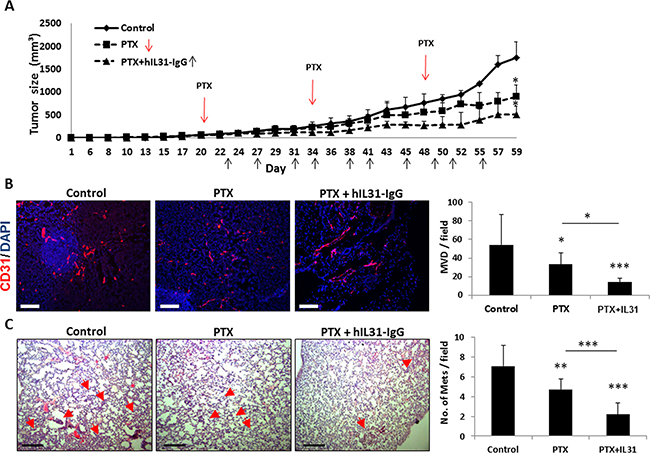 IL31 therapy enhances the anti-cancer activity of paclitaxel chemotherapy.