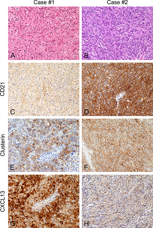 Morphology and phenotype of FDC-S cases submitted for transcriptome sequencing.