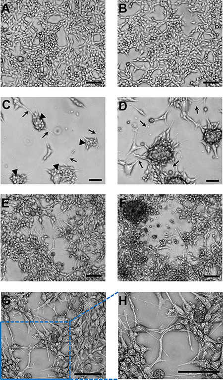 Representative images of the brain cell line growth patterns on adherent plastic compared to monolayer growth of the parental cell line.