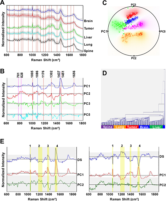 Raman spectroscopic analyses of organ-specific metastatic breast cancer cell lines reveals distinct spectral characteristics for each cell line.