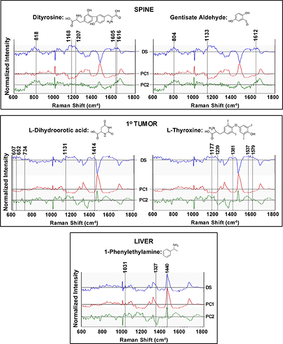 Raman spectroscopic analysis to probe the presence of cell line specific expression of molecules identified through metabolomics analysis.