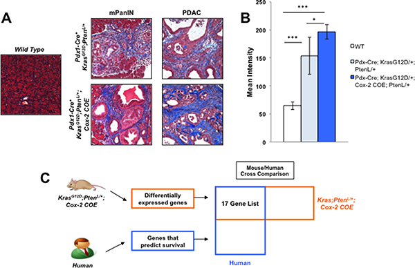 Mouse/Human array data comparison identifies MTSS1 as an inflammation linked gene that predicts poor prognosis in human PDAC.