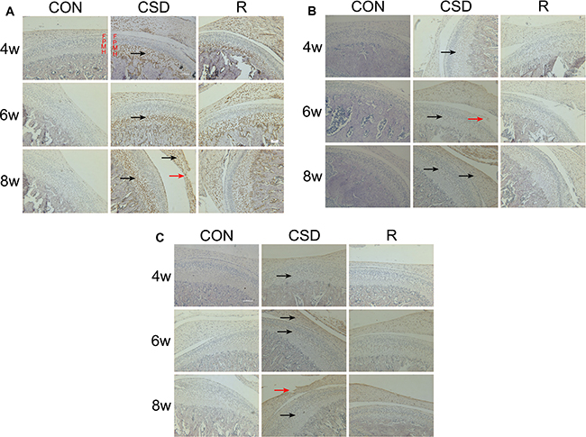 Expression of VEGF, Dll4 and p-ERK1/2 protein in the mandibular condylar cartilage of rat TMJs.