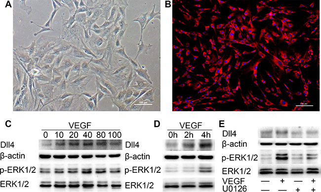 VEGF induces high expression of p-ERK1/2 and Dll4 in MCC cells.