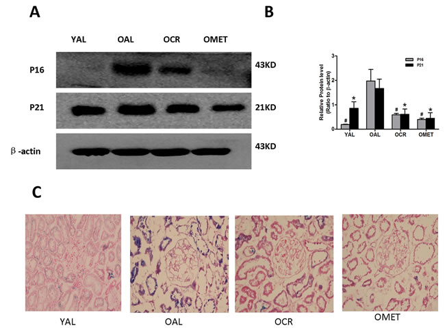 Effect of short-term CR and metformin treatment on cellular senescence in the kidneys of old rats.