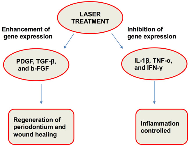Laser treatment results in regeneration and wound healing with inflammation control.