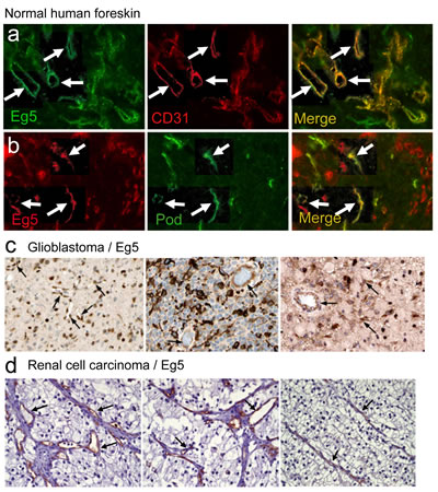 Eg5/KIF11 expression studies in normal and cancerous tissues.