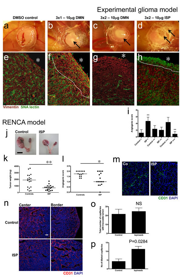 Eg5 inhibition reduces tumor angiogenesis in experimental tumor models.