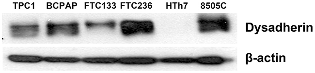 Dysadherin is expressed in human thyroid cancer cell lines.
