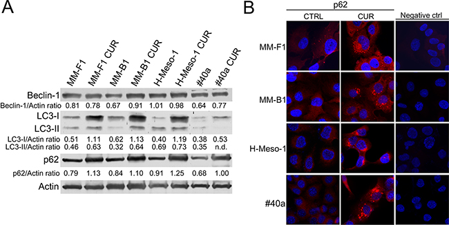 Effect of CUR on the autophagic flux in MM cells.