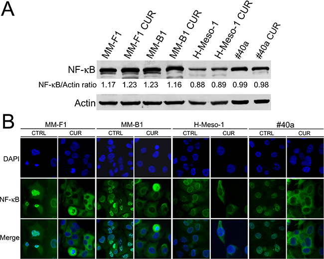 Effect of CUR on NF-&#x03BA;B expression and localization.