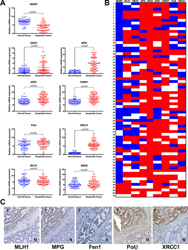 Sporadic colorectal tumours present imbalance of BER genes in comparison to healthy adjacent mucosa.