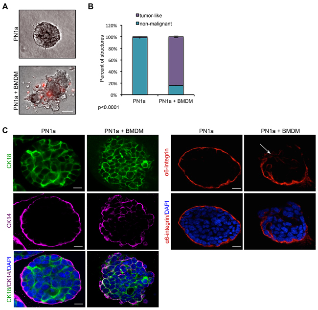 Macrophages induce a malignant phenotype in PN1a cells grown in 3D culture.