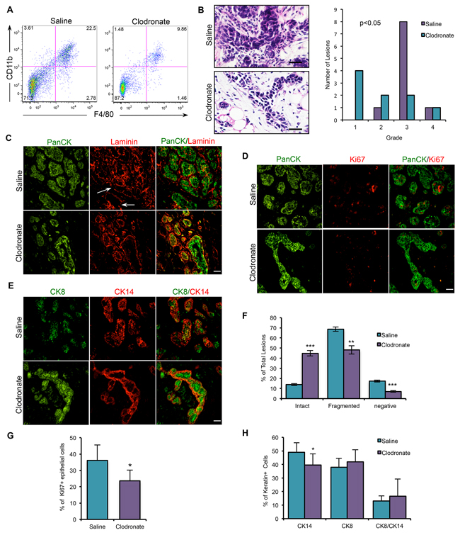 Macrophage depletion using clodronate liposomes impairs the progression of PN1a lesions.