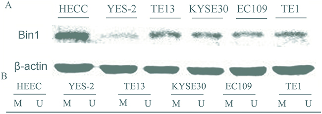 Expression and methylation status of Bin1 in five human esophageal cancer cell lines and human normal esophageal epithelial cells (HEECs).