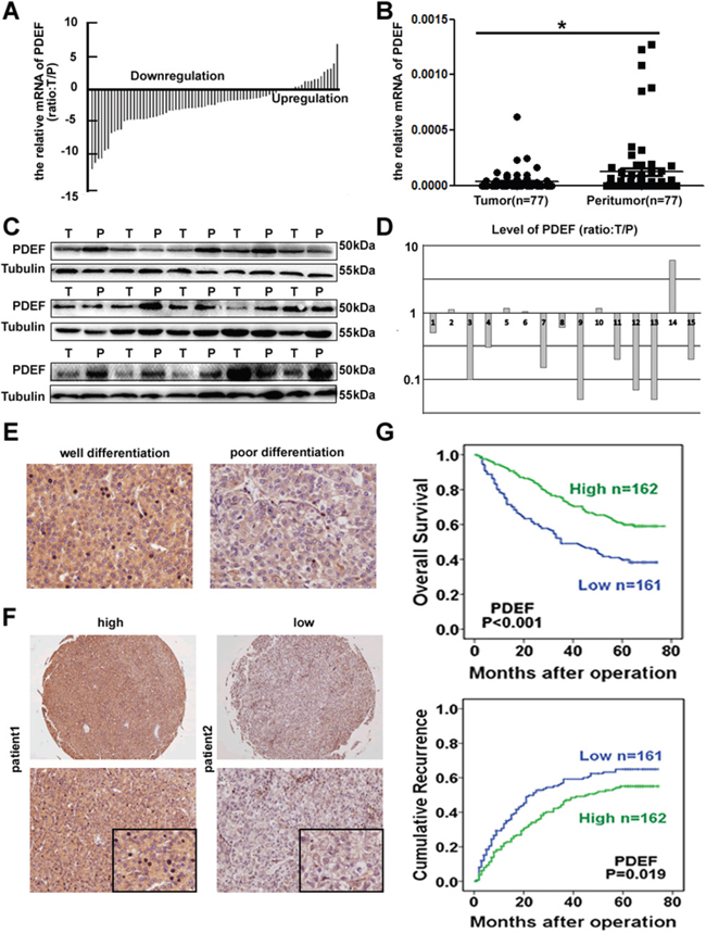 Downregulation of PDEF correlated with human HCCs.