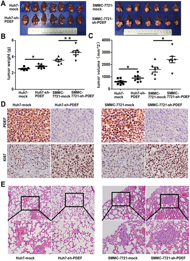 Knockdown of PDEF enhances tumor growth and metastasis in vivo.