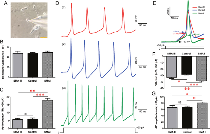 Excitability analysis of iPSC derived mature MNs by electrophysiology in current-clamp mode.