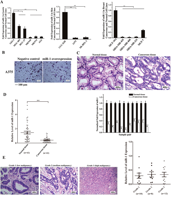 Downregulation of miR-1 in gastric cancer cells and tissues.