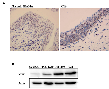 Detection of VDR expression in human bladder.