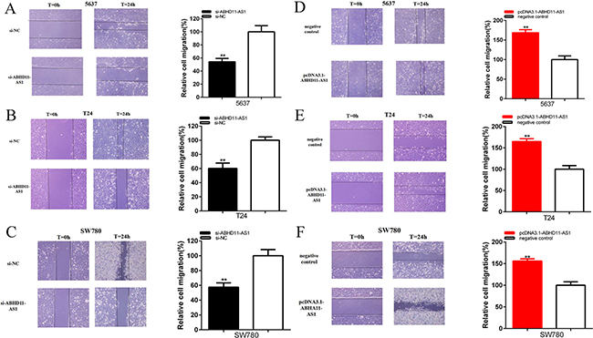 Effects of specific RNA and specific plasmids on cell migration.