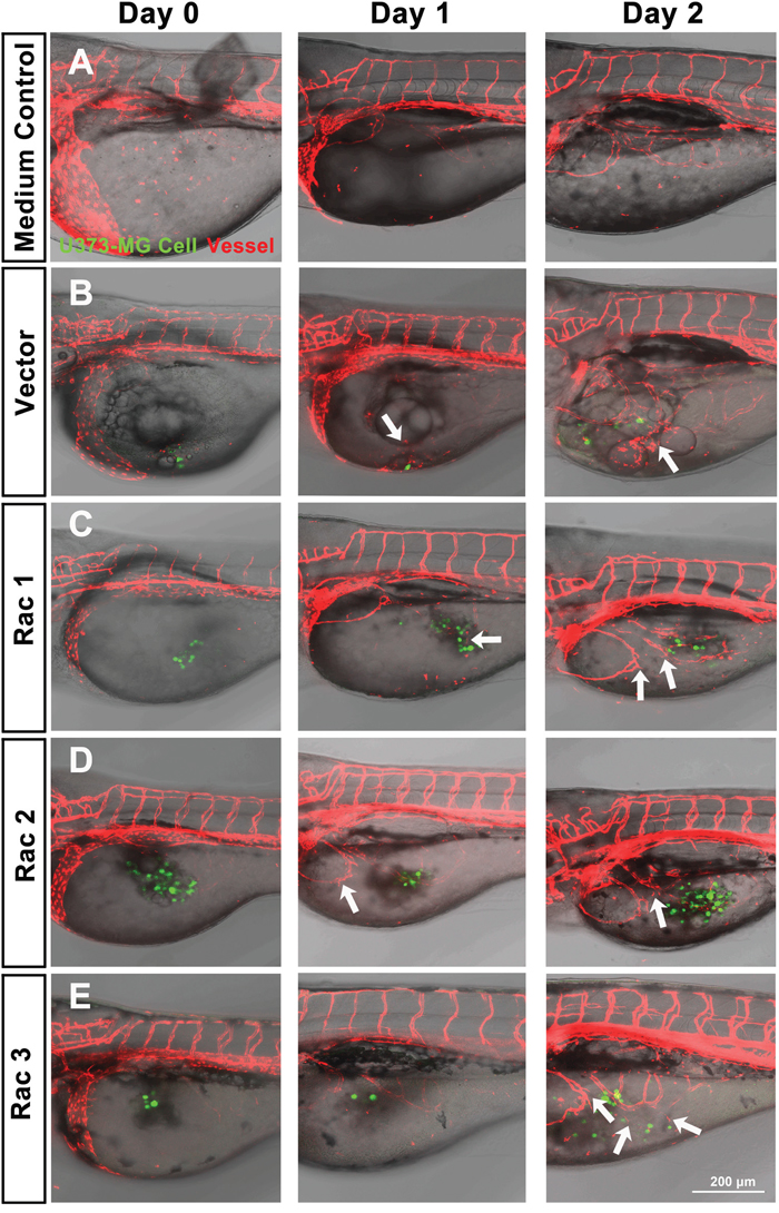 In vivo zebrafish xenotransplantation model of U373-MG tumorsphere cells with overexpressed Racs.