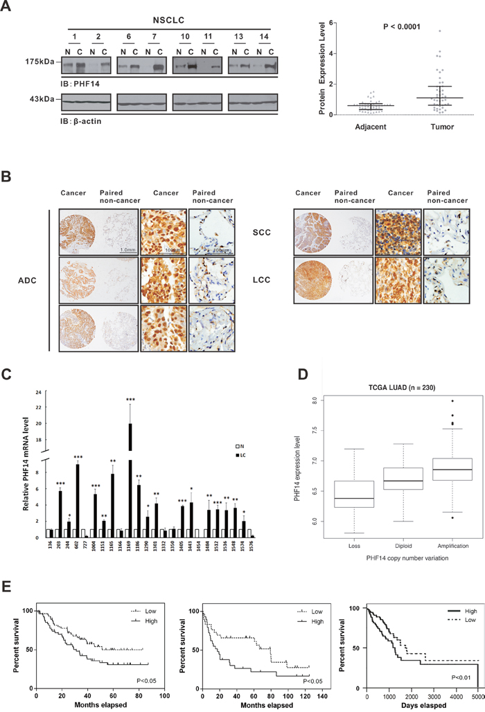 Upregulation of PHF14 in lung cancer is significantly associated with poor prognosis.