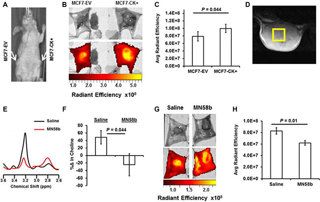 NIRF imaging for JAS239 accumulation can detect genetic overexpression and pharmacologic inhibition of ChoK&#x03B1;.