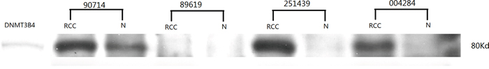 The analysis of DNMT3B4 expression using Western blot in ccRCC and adjacent normal tissues.