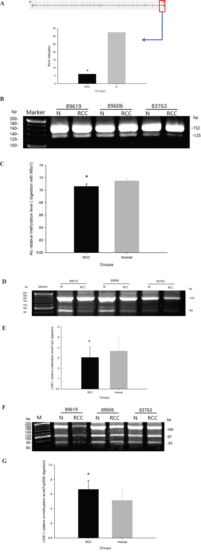 Global methylation of Sat2, Alu and LINE-1 in ccRCC and adjacent normal tissues.