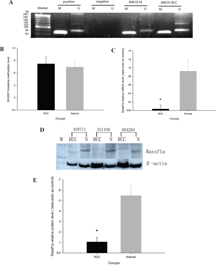 The expression and methylation of RASSF1A in ccRCC and adjacent normal tissues.