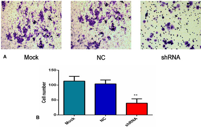 AEG-1-shRNA inhibited the invasion of the H460 cells.