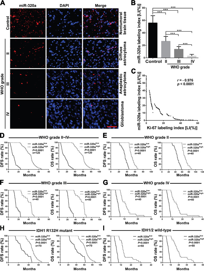 miR-320a expression correlates with grades, proliferation, IDH status and prognosis in human gliomas.