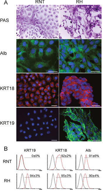 Profiling of typical hepatocyte markers in RNT and RH cells.