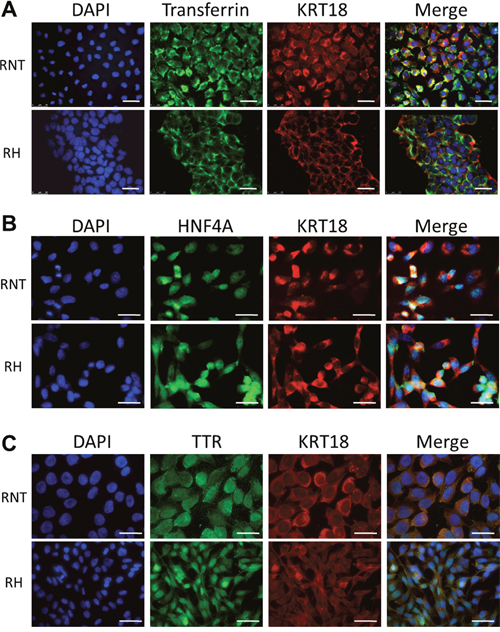 Expression of transferrin, hepatocyte nuclear factor 4 alpha and transthyretin in RNT and RH cells.