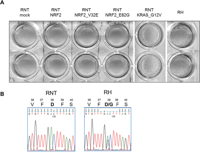 NRF2 transduction is not sufficient to transform RNT cells.