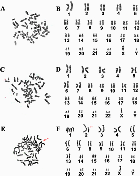 Karyotype analysis of the immortalized human Sertoli cells.
