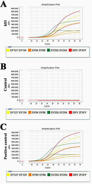 Y chromosome microdeletion analysis of the immortalized human Sertoli cells.