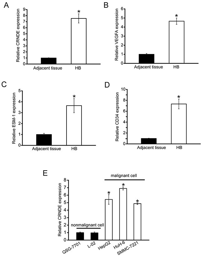 CRNDE is significantly up-regulated in human hepatoblastoma specimens and cell lines.