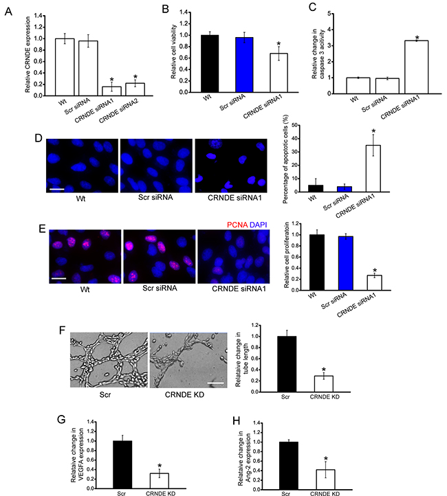 CRNDE knockdown decreases cell viability, proliferation, and tube formation in vitro.