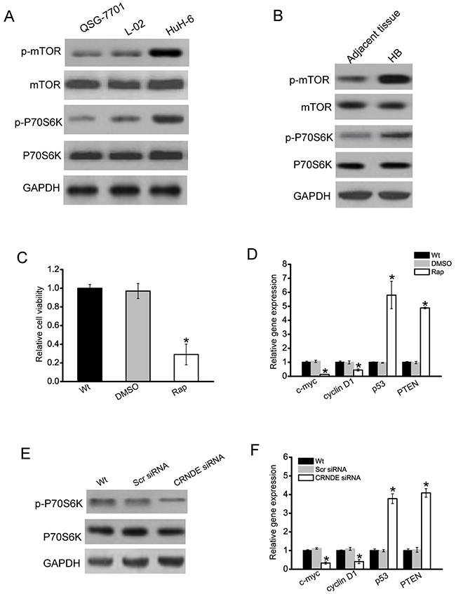 CRNDE regulates the development of hepatoblastoma through mTOR signaling.