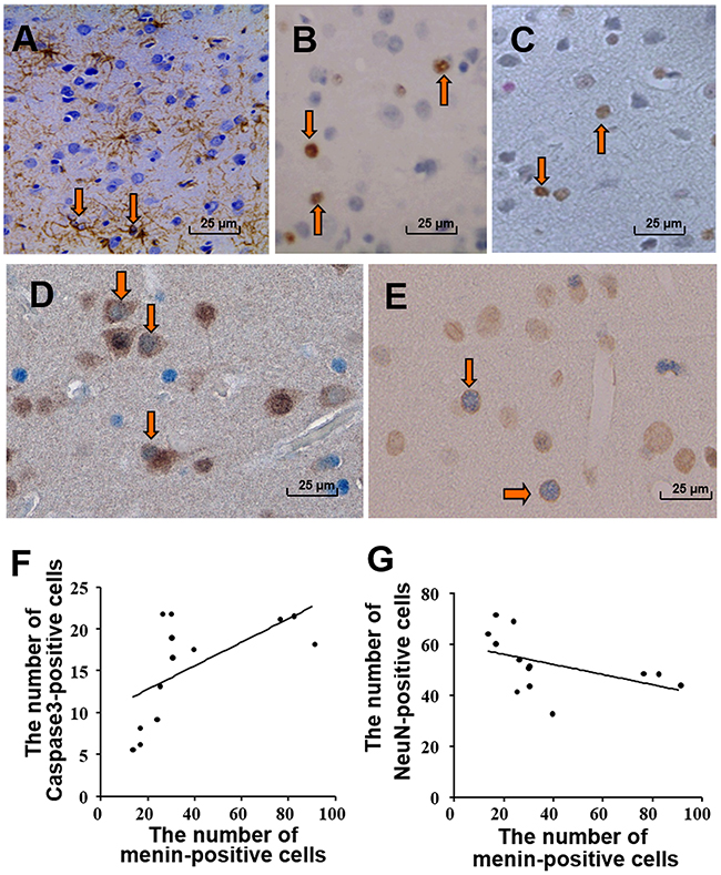 Menin expression was correlated with neuronal damage in SIV-infected macaques.