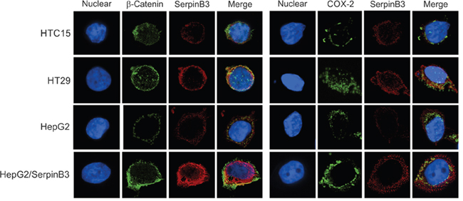 Immunofluorescence analysis of SerpinB3, COX-2 and &#x03B2;-Catenin.