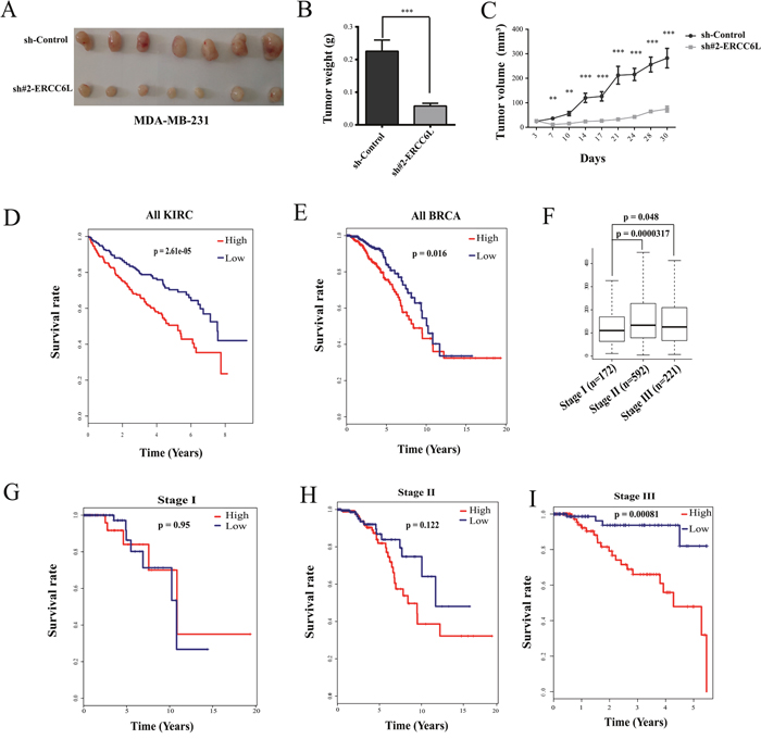 Effect of ERCC6L silencing on tumor growth and associations of ERCC6L expression with clinical survival and progress of breast and kidney cancer.