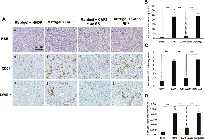 &#x03B1;AMR inhibit the angiogenesis and lymphangiogenesis induced-CAFs in an in vivo Matrigel plug bioassay.