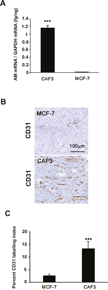 MCF-7 cells showed barely detectable angiogenesis compared to CAFs in an in vivo Matrigel plug bioassay.