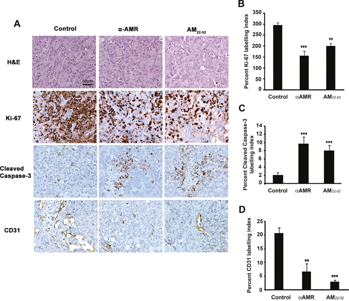 AM blockade induces apoptosis and impairs angiogenesis in MCF-7/CAFs tumor xenografts.
