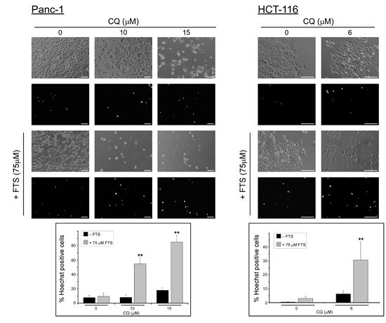 Chloroquine enhances FTS-induced cell death.